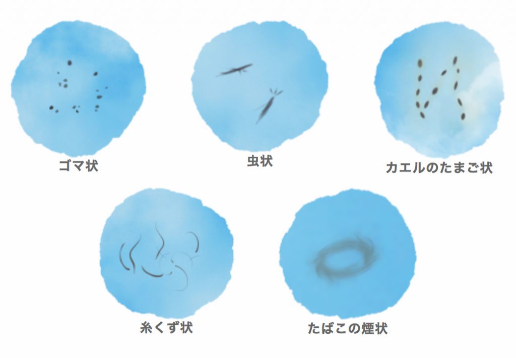 視界 に 黒い 糸 くず