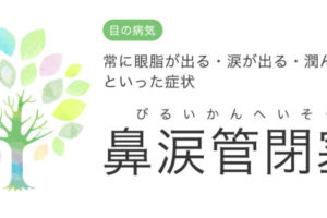 涙が出る なみだ目になる原因は 中央眼科グループ