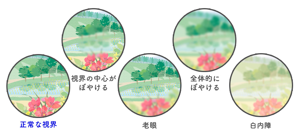 目がぼやける 原因と対処法 中央眼科グループ