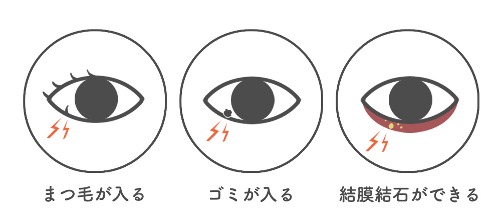 目がゴロゴロの原因と症状