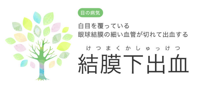 の 出血 原因 白目 結膜下出血（よくある目の病気 39)