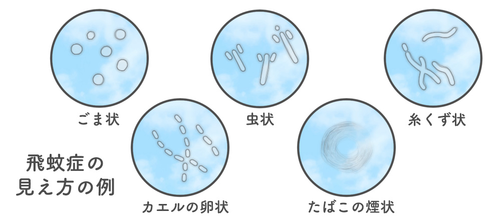 目 に 黒い もの が 飛ぶ