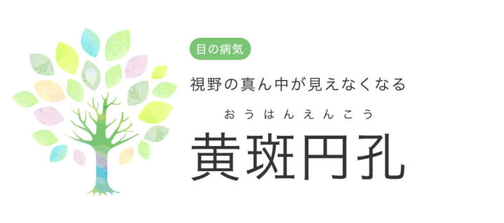 視野の真ん中が見えなくなる黄斑円孔