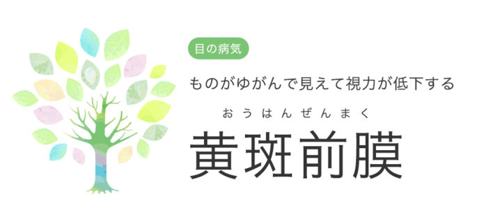 黄斑前膜