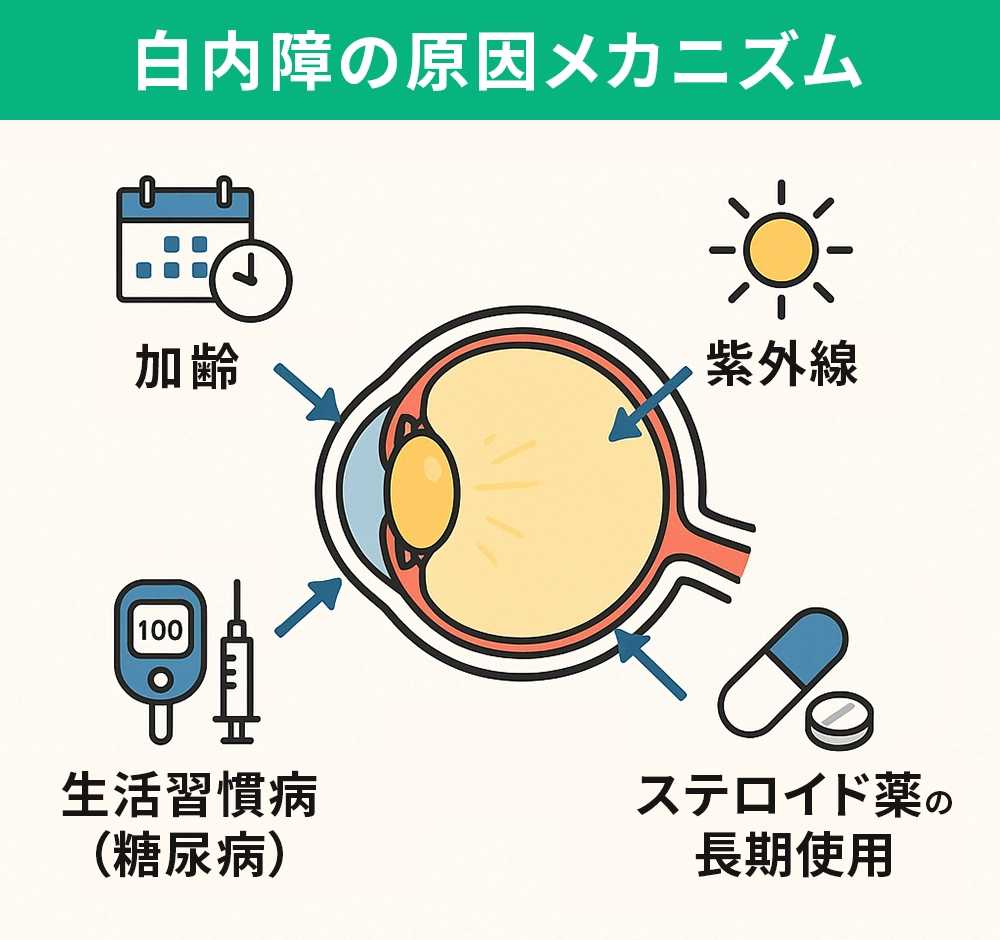 白内障のメカニズム